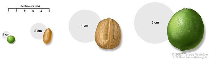 Pea, peanut, walnut, and lime show tumor sizes.